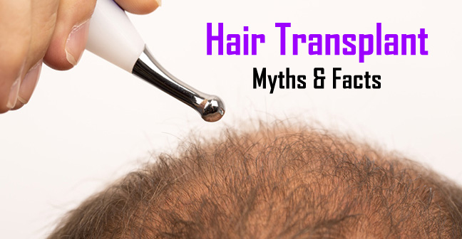 Distinguish Facts from myths about Hair transplant Istanbul 